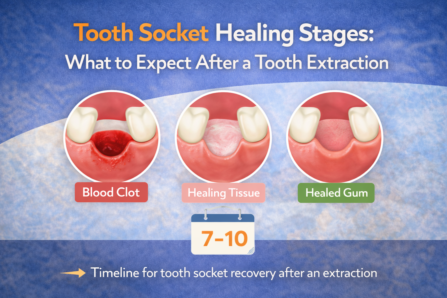 An infographic showing the healing stages of a tooth socket after an extraction. It includes three illustrations with labels: "Blood Clot," "Healing Tissue," and "Healed Gum." Below, there's a calendar icon with a timeline indicating the recovery period of 7-10 days.