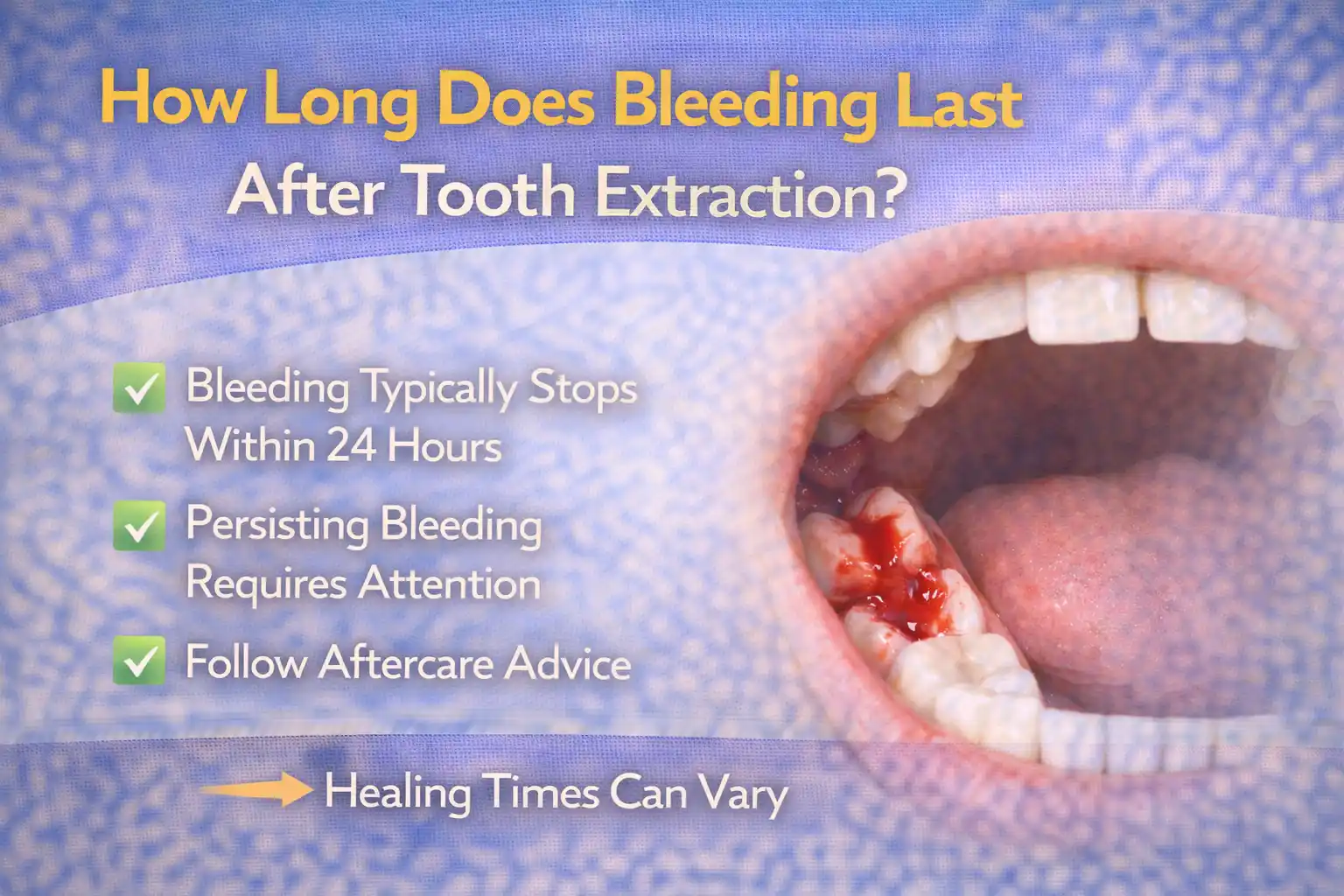 Infographic explaining how long bleeding lasts after tooth extraction, highlighting typical healing time, signs to watch for, and aftercare tips for managing bleeding.