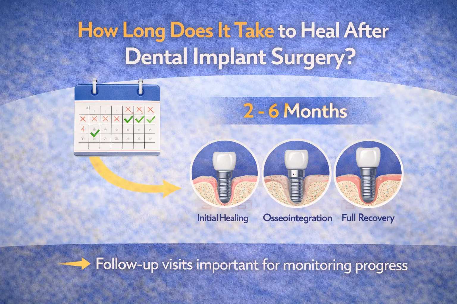 Dental implant healing timeline showing recovery stages over 2 to 6 months.