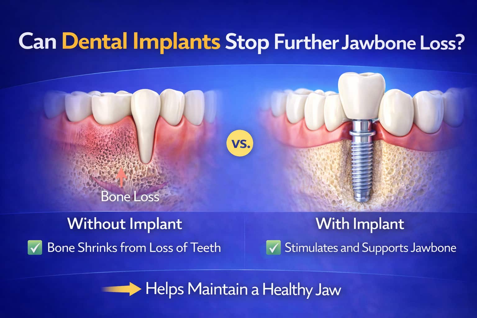 a comparison of jawbone recession without an implant vs. the preservation of bone with an implant, highlighting key benefits like bone support and stimulation.